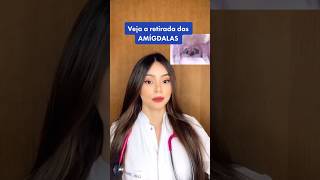 AMIGDALECTOMIA COMO É A CIRURGIA DE RETIRADA DAS AMÍDALAS [upl. by Dougie]