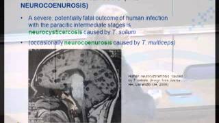 Taenia solium cysticercosis Life cycle epidemiology and diagnosis Dr L Odendaal [upl. by Konstantin]