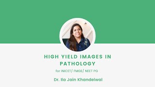 High yield images in Pathology for FMGE  Haematology  Dr Ila Jain Khandelwal [upl. by Ermanno]