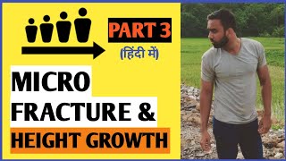 How to increase height ऊंचाई with microfractures PART 3 [upl. by Aicekat]