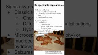 Congenital toxoplasmosis [upl. by Koloski113]