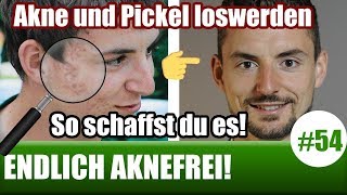 Was hilft gegen Pickel  Ursachen Lösungen Ernährung  Akne loswerden ENDLICH AKNEFREI 54 [upl. by Aciraa397]