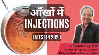 Eye injections simplified जानिये 2023 में आँखों में injections के सभी options [upl. by Idnarb456]