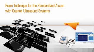 Exam Technique for Standardized A scan [upl. by Cary828]