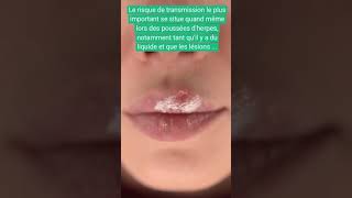 HERPES LABIAL  comment se transmetil [upl. by Anetsirk]