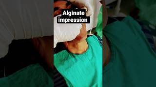 Upper Dental impression dental Alginate impression [upl. by Oinotnas]