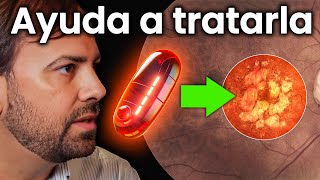 Estos Micronutrientes Ayudan con la DMAE Estudio AREDS y AREDS 2 [upl. by Tamer342]