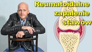 Reumatoidalne zapalenie stawów  dr Michał Lange [upl. by Huxley]