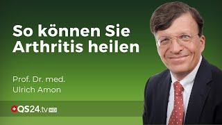 Schuppenflechte und PsoriasisArthritis sind längst heilbar  Prof Dr med Ulrich Amon  QS24 [upl. by Amaleta]