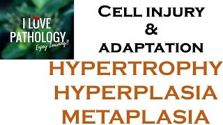 Cell Adaptations pathologyHYPERTROPHY HYPERPLASIA AND METAPLASIA [upl. by Kiefer]