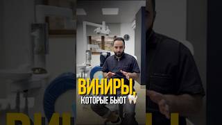 ЭТИ ВИНИРЫ ИСПОРТЯТ ВАШИ ЗУБЫ [upl. by Rhiana]