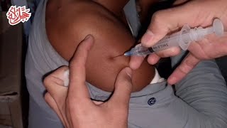 injection vlog new hospital boy  im injection kaise lagate hai  injection vlogs latest [upl. by Alleroif]