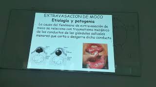 Gastroenterologia teórica Patologias de las glándulas salivales 12032024 [upl. by Oicaro721]