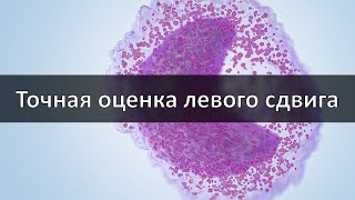 Точная оценка левого сдвига в современном анализе крови Палочки или новые технологии [upl. by Encrata25]