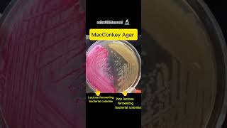 lactose fermenting and non lactose fermenting bacterial colonies on MacConkey Agar  bacteria [upl. by Ellenehc208]