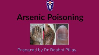 General Toxicology  Arsenic poisoning [upl. by Hamburger]