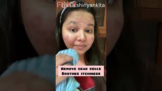 No More Oily Skin Thanks To The WOW Anti Acne Face Wash  Ankita Goyal [upl. by Mungovan]