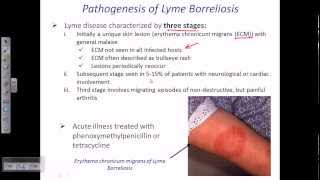 Lyme disease by borrelia [upl. by Ahilam]