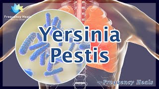 Relieve Yersinia Pestis  Energy amp Quantum Medicine  Healing Frequency  Raise Vibrations [upl. by Fabio]