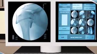 What to Expect during an Athrogram procedure at CDI [upl. by Luapsemaj]