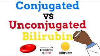 Conjugated vs Unconjugated Bilirubin  Simple Explanation [upl. by Courcy]