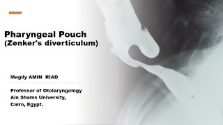 Pharyngeal Pouch  Zenkers diverticulum [upl. by Sivia]