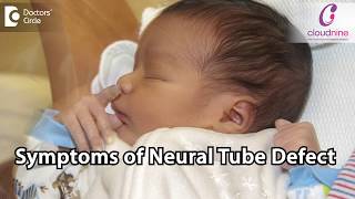 What are the symptoms of Neural Tube Defects  Dr Tanushri Mukherjee of of Cloudnine Hospitals [upl. by Fillbert]