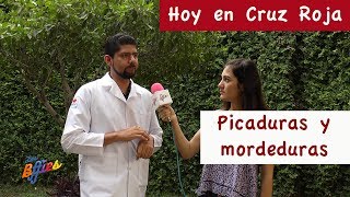 Qué hacer con picaduras y mordeduras de insectos [upl. by Dalia]