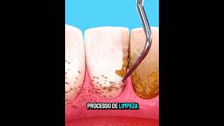 Essa pode ser sua melhor escolha para limpar os Dentes🤔 [upl. by Gniliem]