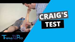 Craigs Test  Femoral Anteversion  Femoral Retroversion [upl. by Ahseen]