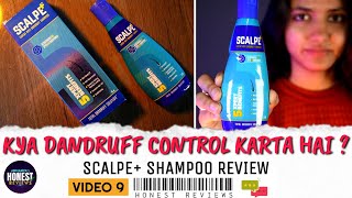 4 Weeks Scalpe Shampoo Review Ketoconazole amp Zinc Pyrithione AntiDandruff Shampoo  SCALPE PLUS [upl. by Sclater]