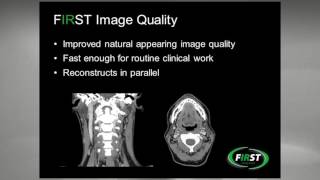 SCCT 2016 Dr Marcus Y Chen Presents FIRST MBIR Reconstruction to Improve Imaging [upl. by Ajiram]