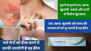 LabodermOC Cream to Treat Mixed Dermatitis Conditions  LabodermOC Review  Anti Fungal Cream [upl. by Rosalinda476]