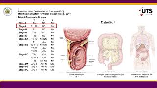 TELECAPACITACION ESTADIFICACION TNM CANCER DE COLON GUIA NCCN [upl. by Hew491]