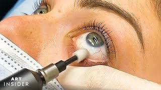 Eyelid Microexfoliation Cleanses Your Eyes [upl. by Rybma]