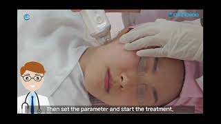 ELLISYS SENSE Vacuum Fractional Microneedle Radio Frequency SystemMNRF  MadeinKorea UNITYDERMA [upl. by Vod]