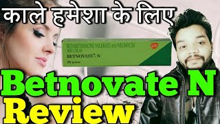 Betnovate N Cream Side Effect  Betnovate N Review [upl. by Jaan]