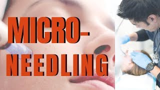 MICRO NEEDLING What you need to know from dermatologist  Dr Davin Lim [upl. by Binetta]