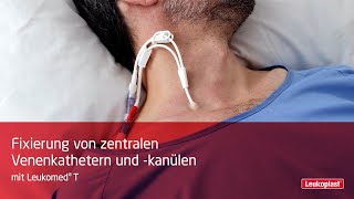 Wie man einen zentralen Venenkathetern und kanülen mit Leukomed T fixiert [upl. by Anirrok282]