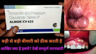 almox cv 625 tablets uses in hindi amoxycillin and potassium clavulanate tablets uses in hindi [upl. by Hardi]