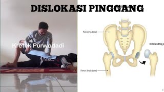 Pinggul dislokasi langsung sembuh bonesetting chiropractic kretekpurwodadi pengobatanalternatif [upl. by Hras]