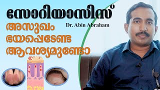 Psoriasis സോറിയാസിസ് അറിയേണ്ടതെല്ലാം  Malayalam Healthy Tips Dr Abin Abraham [upl. by Notniv]