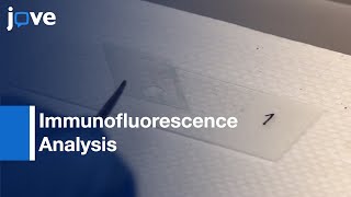 Immunofluorescence Analysis EndogenousExogenous CentromereKinetochore Proteins l Protocol Preview [upl. by Lianne10]