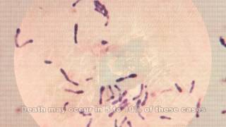 Corynebacterium diphtheriae amp Diphtheria [upl. by Adlesirhc]