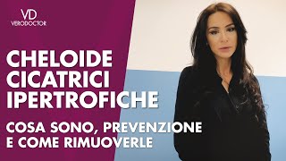 CHELOIDE o CICATRICI IPERTROFICHE cosa sono prevenzione e come rimuoverle  VERODOCTOR [upl. by Petrine]