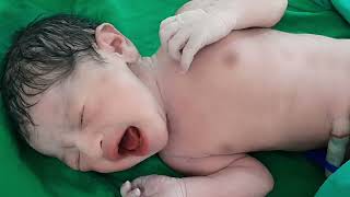 Just after birth newborn baby crying and cute activitycutebaby [upl. by Tnomad]