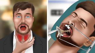 ASMR Animation Remove fish bones stuck in MrBeasts throat [upl. by Hnoj]