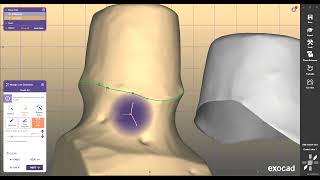 Exocad Exoplan 3Shape InLab Cerec 3ShapeUnite MillboxVHF Millbox DentalWingsDwos [upl. by Reni]