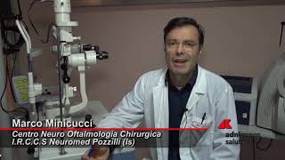 Cheratocono patologia degenerativa della cornea [upl. by Powe]