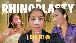 My Rhinoplasty Journey Before During and After Surgery  Anna Magkawas [upl. by Vickey99]